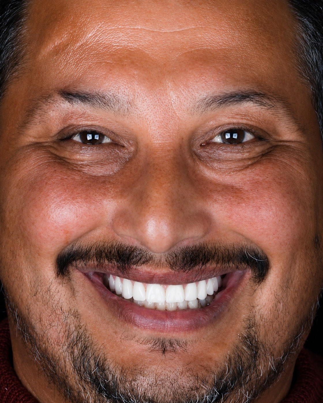Paciente adulto sorrindo após tratamento